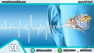 سکته گوش چست؟ آیا سکته گوش درمان دارد؟