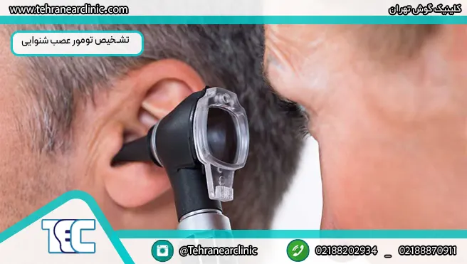 تشخیص تومور عصب شنوایی