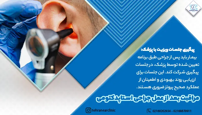 مراقبت بعد از عمل جراحی استاپدکتومی