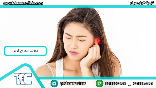 عفونت سوراخ گوش چیست؟