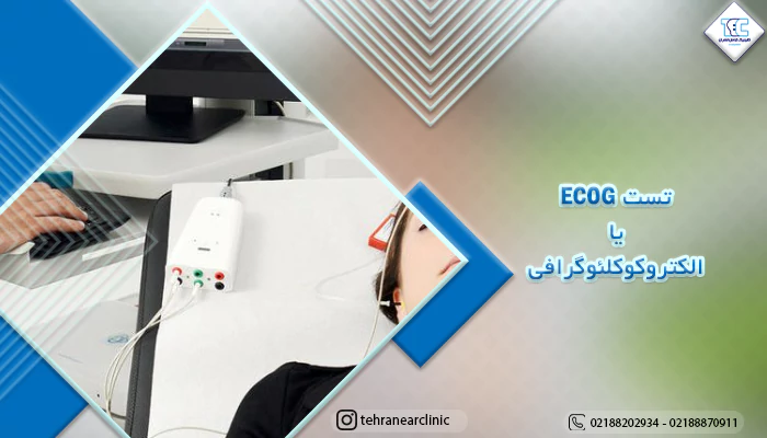 تست ECOCHG یا الکتروکوکلئوگرافی چیست؟