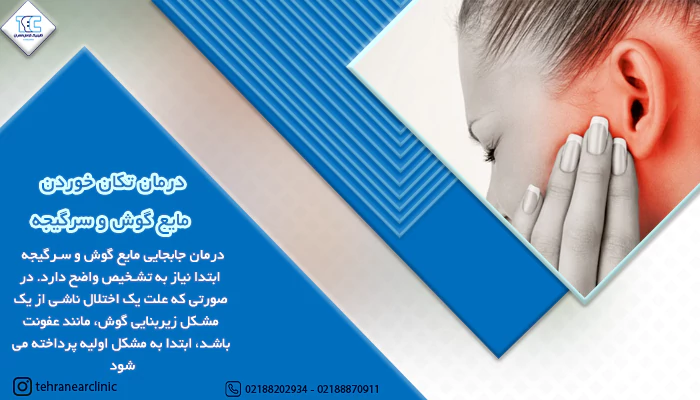 درمان تکان خوردن مایع گوش