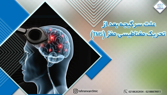 علت سرگیجه بعد از تحریک مغناطیسی مغز (TMS)
