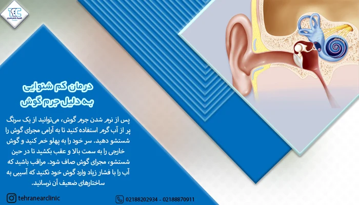 درمان کم شنوایی به دلیل جرم گوش