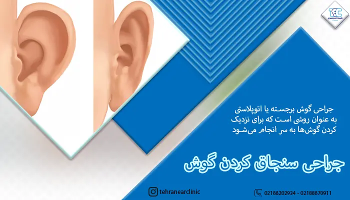 جراحی سنجاق کردن گوش