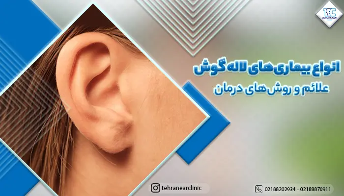 انواع بیماری‌های لاله گوش