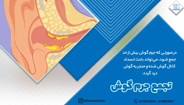 گوشی که دچار تجمع جرم گوش شده و دارای درد است!