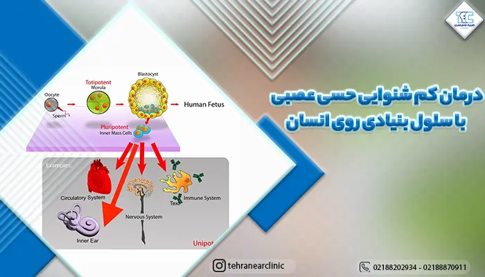 عکس حاوی اطلاعاتی در مورد درمان کم شنوایی حسی عصبی با سلول بنیادی روی انسان