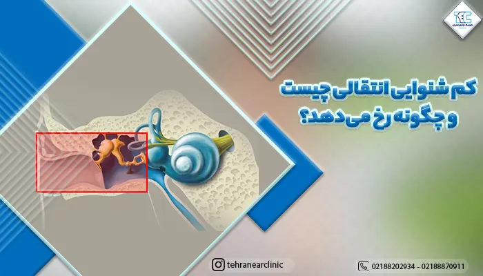 تصویر گوش داخلی و توضیح کم شنوایی انتقالی