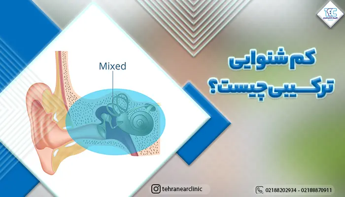 تصویر گوش داخلی و معرفی کم شنوایی ترکیبی Mixed Hearing Loss