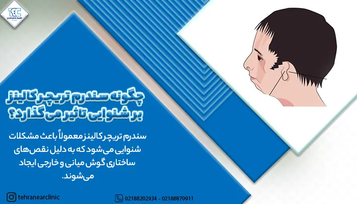 توضیح تاثیر سندرم تریچر کالینز بر شنوایی