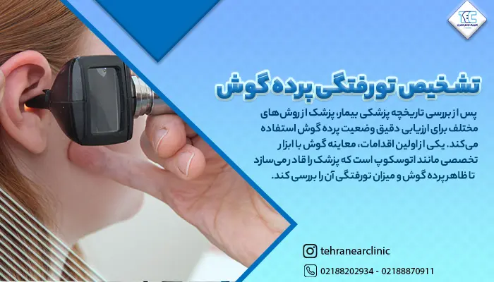 تشخیص تورفتگی پرده گوش
