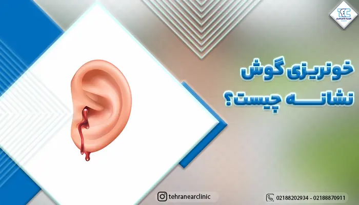 تصویر خونریزی گوش
