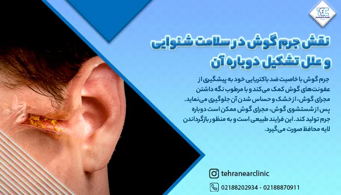 جرم گوش خانم جوان و نقش آن در سلامت شنوایی