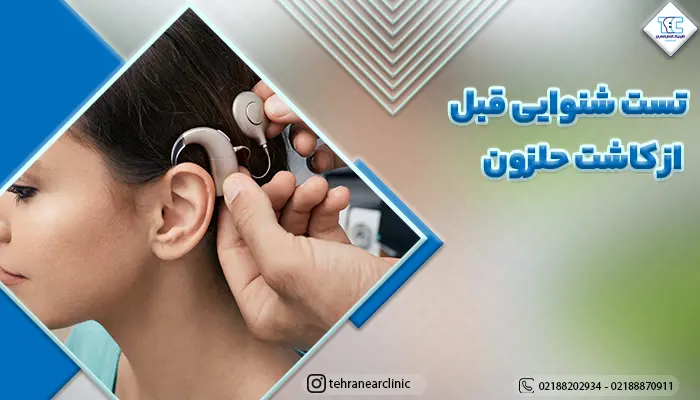پزشک در حال تست شنوایی قبل از کاشت حلزون