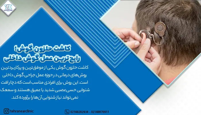 رایج ترین جراحی گوش داخلی کاشت حلزون
