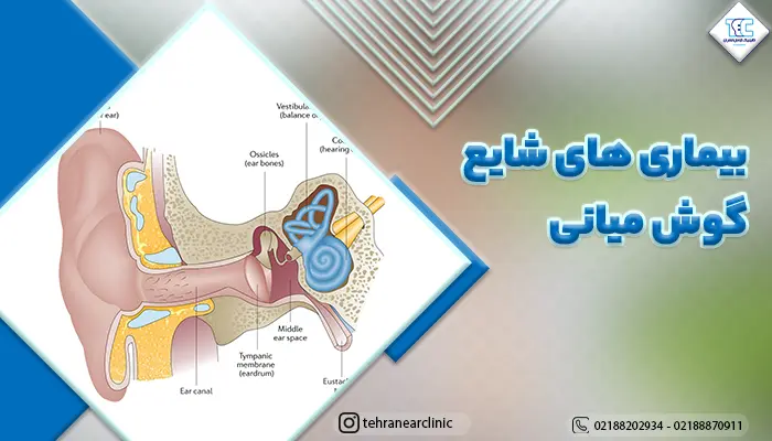 تصویر گوش میانی و معرفی انواع بیماری های گوش میانی