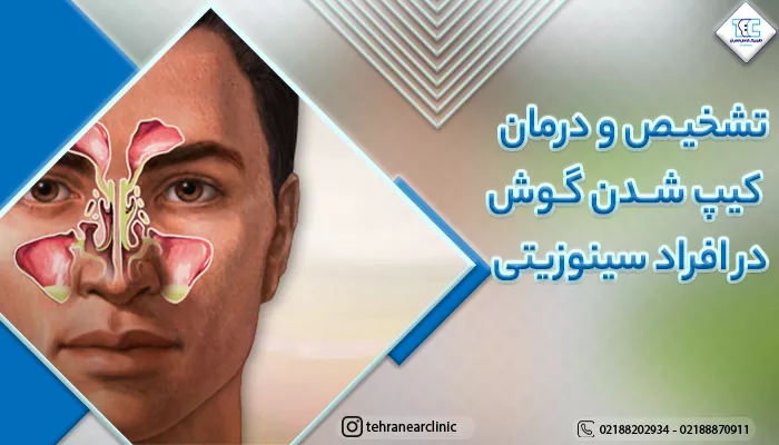 وکتور سینوزیت و گرفتگی گوش